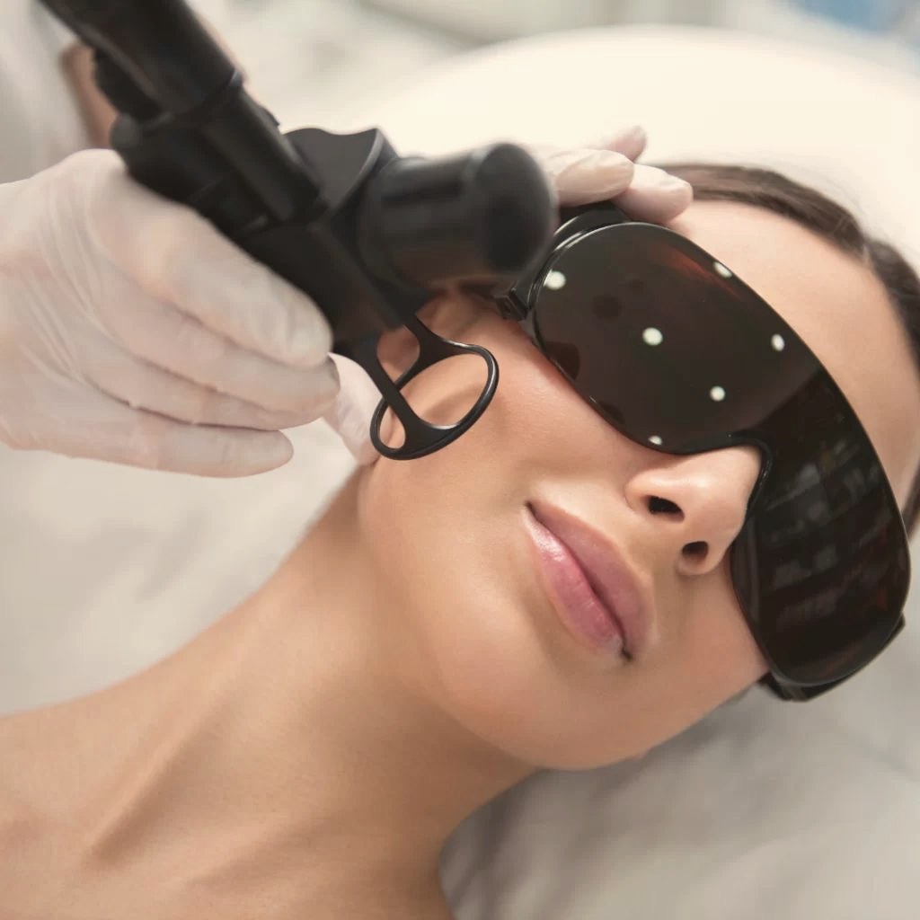 Laser de CO2 Full Face